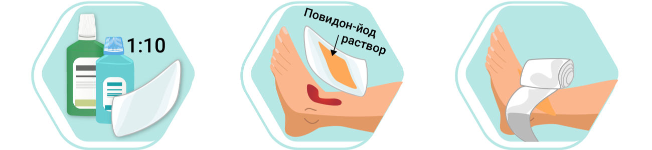Обработка ран